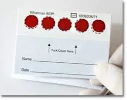 allergietest met gebruik van dry blood spot